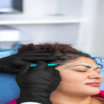 forehead lift in Toronto