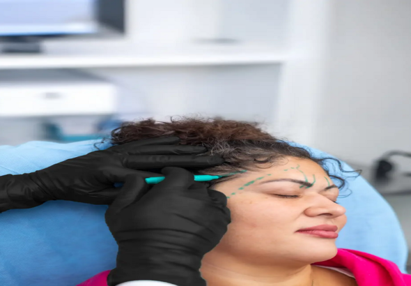 forehead lift in Toronto