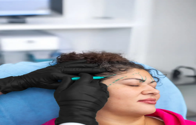 forehead lift in Toronto